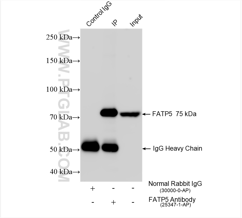 IP experiment of rat liver using 25347-1-AP