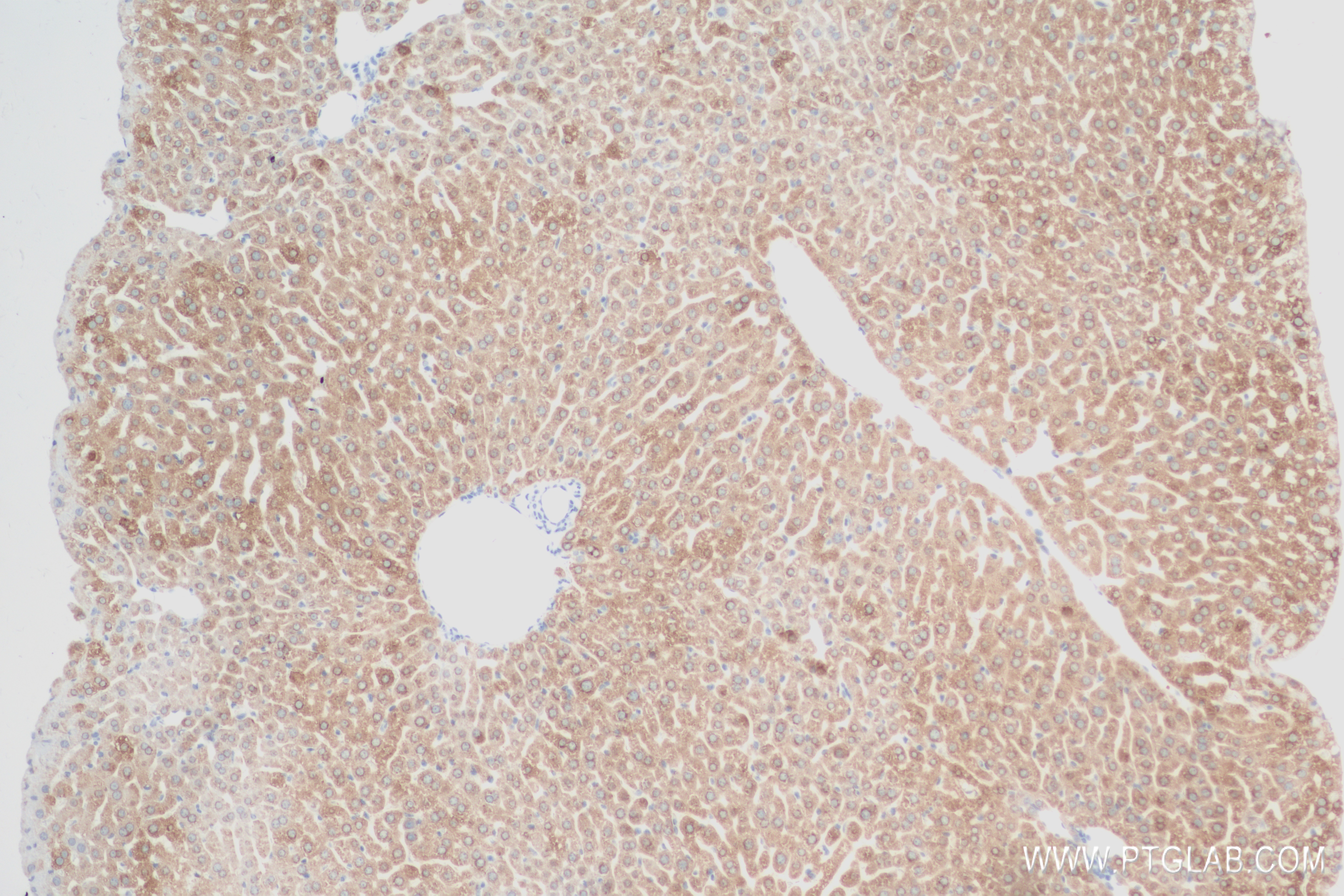 IHC staining of mouse liver using 84557-1-RR