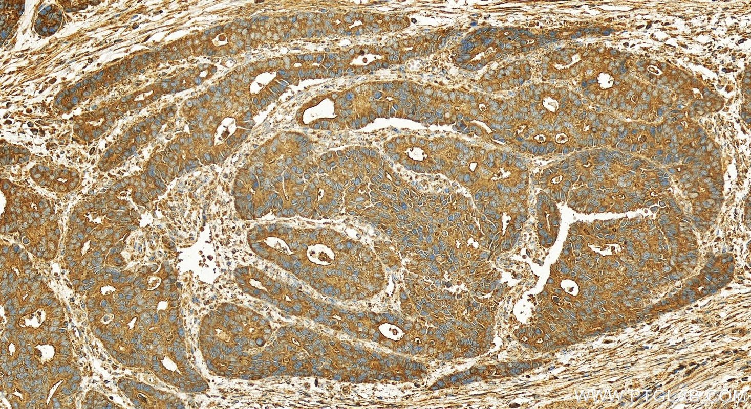 IHC staining of human stomach using 13581-1-AP