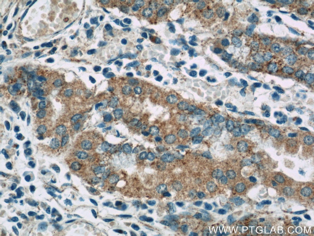 IHC staining of human stomach using 13581-1-AP