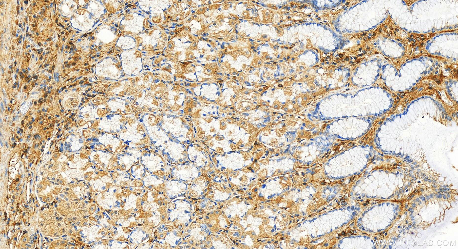 IHC staining of human stomach using 20425-1-AP