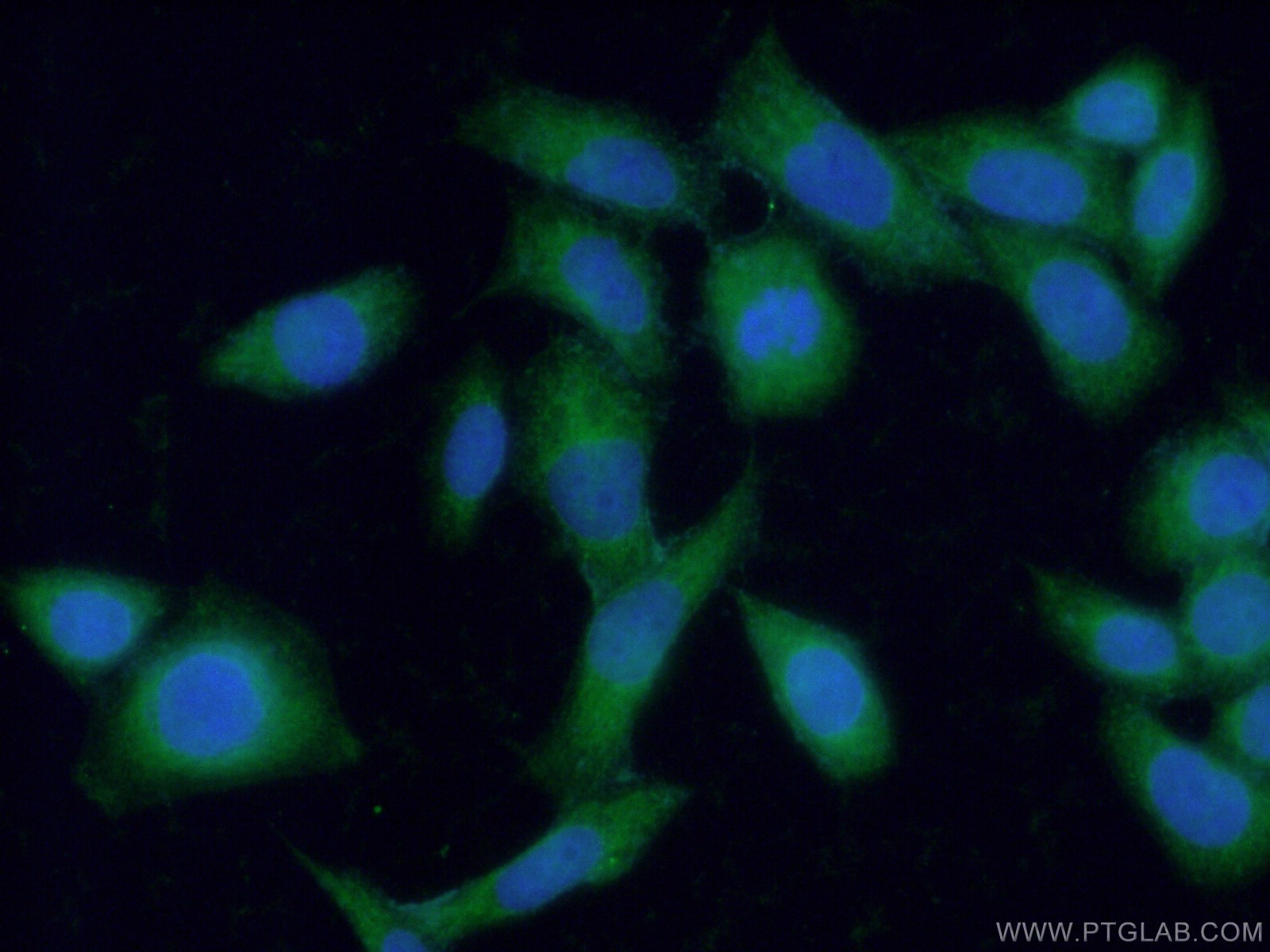 IF Staining of HeLa using 20425-1-AP