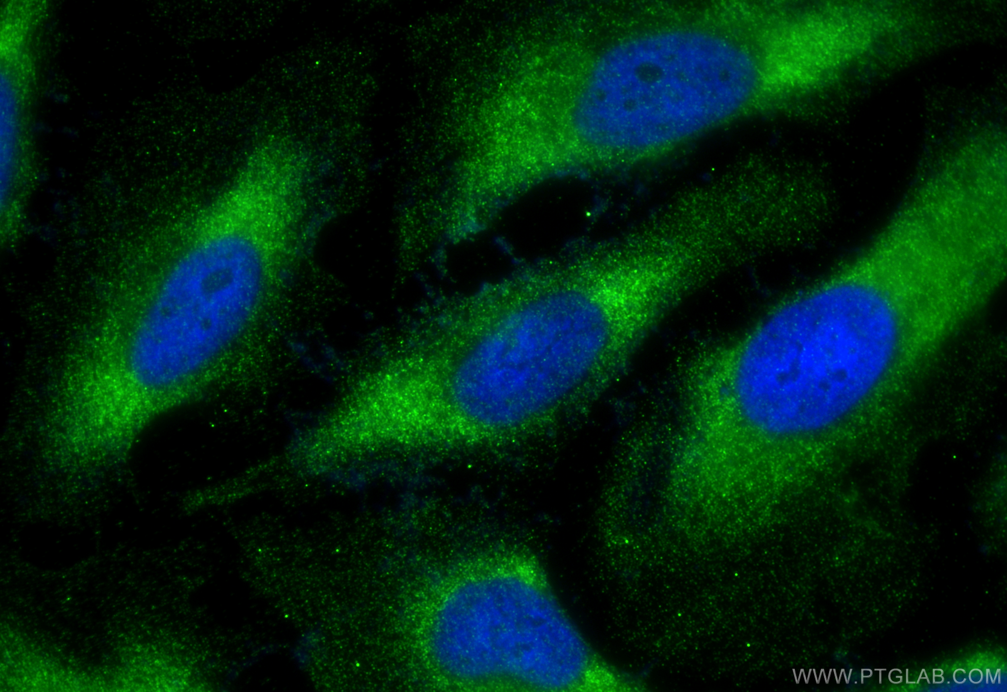 IF Staining of HeLa using 12842-1-AP