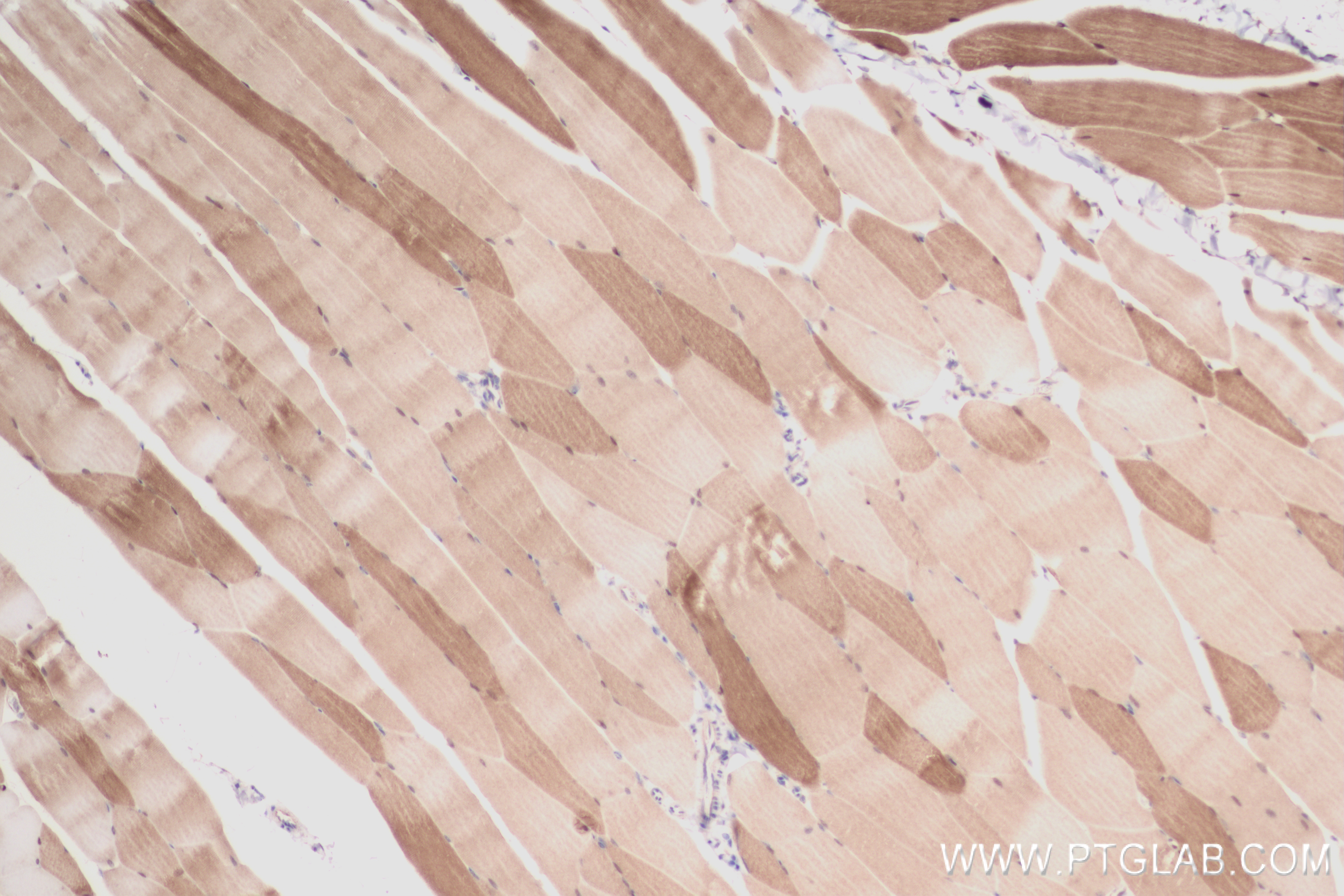 IHC staining of mouse skeletal muscle using 83910-5-RR