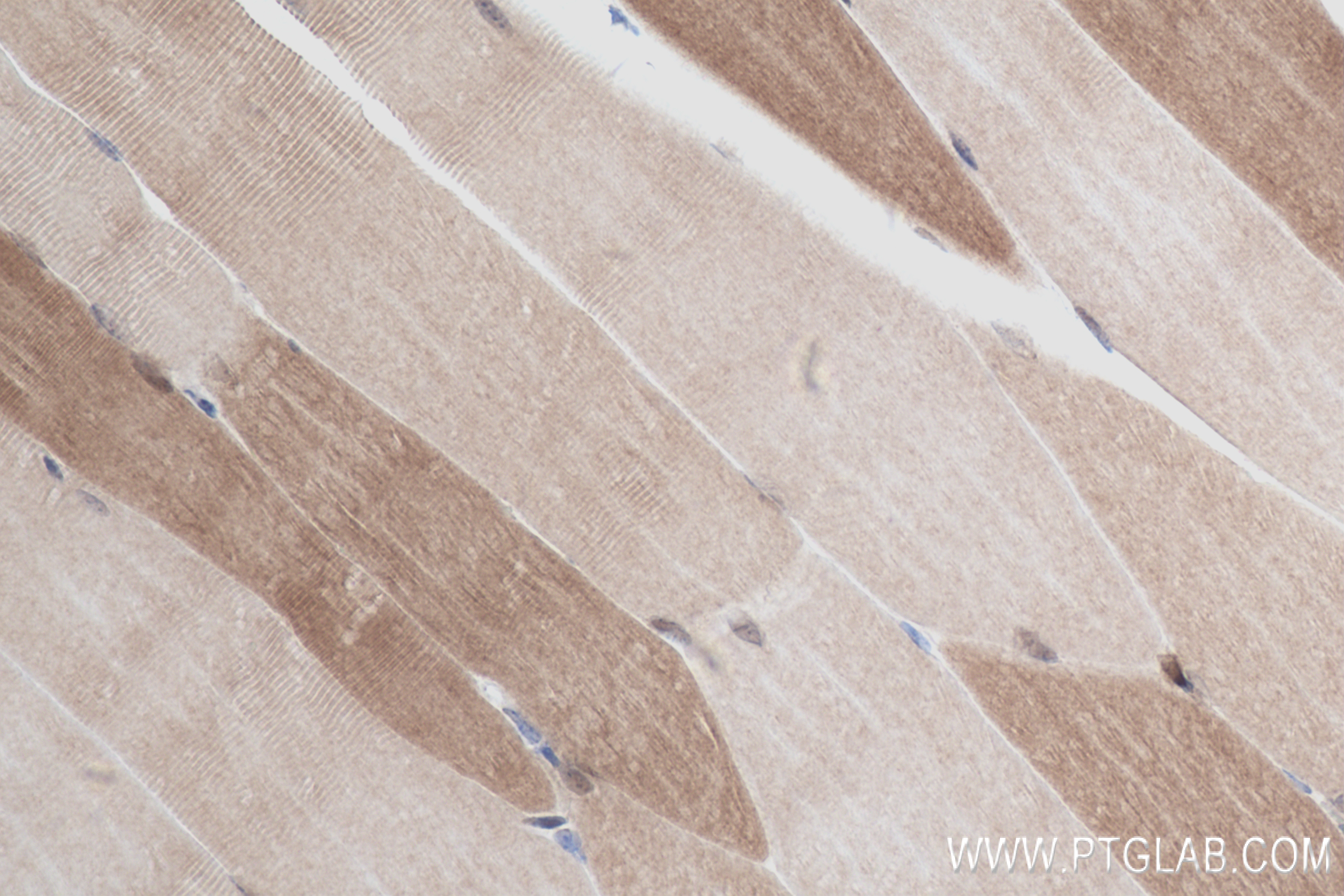 IHC staining of mouse skeletal muscle using 83910-5-RR