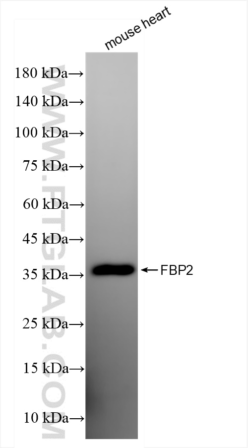 WB analysis of mouse heart using 83910-5-RR