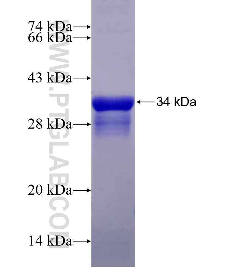 FBRS fusion protein Ag30245 SDS-PAGE