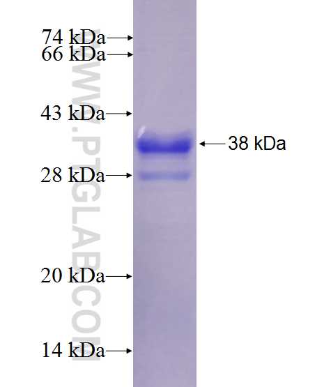 FBXO16 fusion protein Ag27580 SDS-PAGE