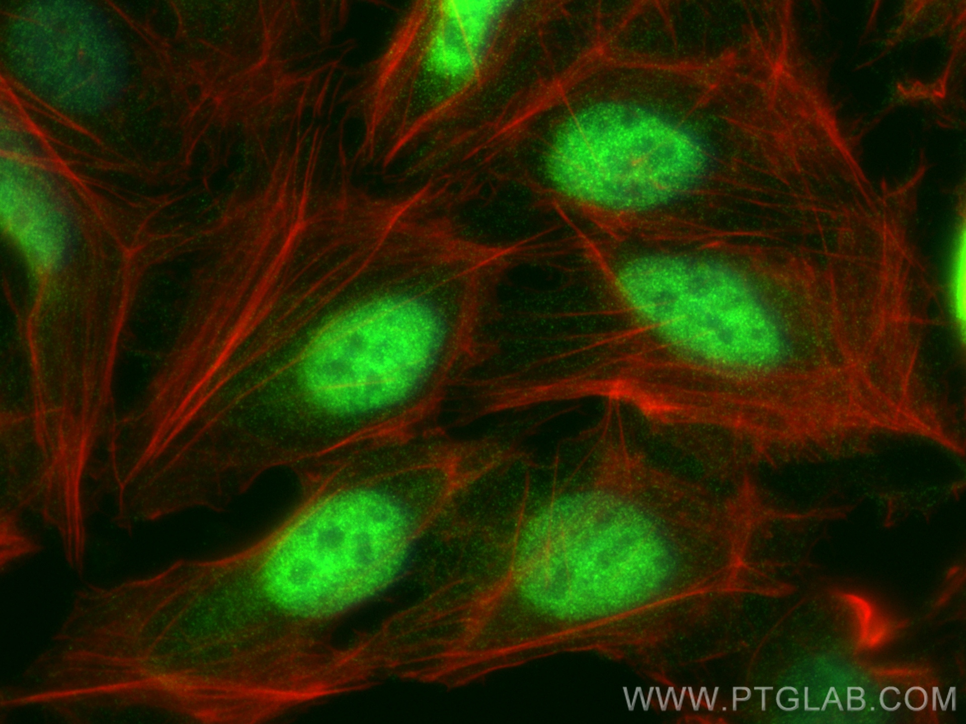 IF Staining of U2OS using 82857-2-RR