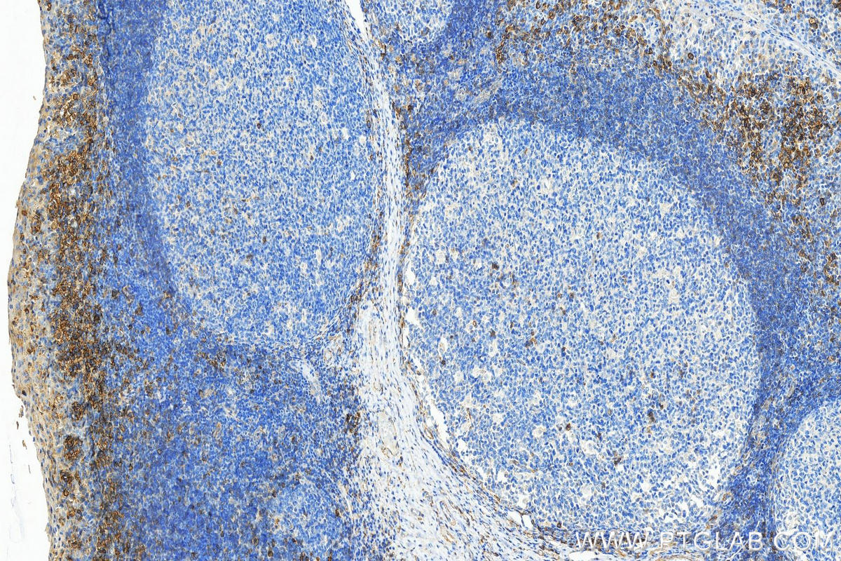 IHC staining of human tonsillitis using 21541-1-AP