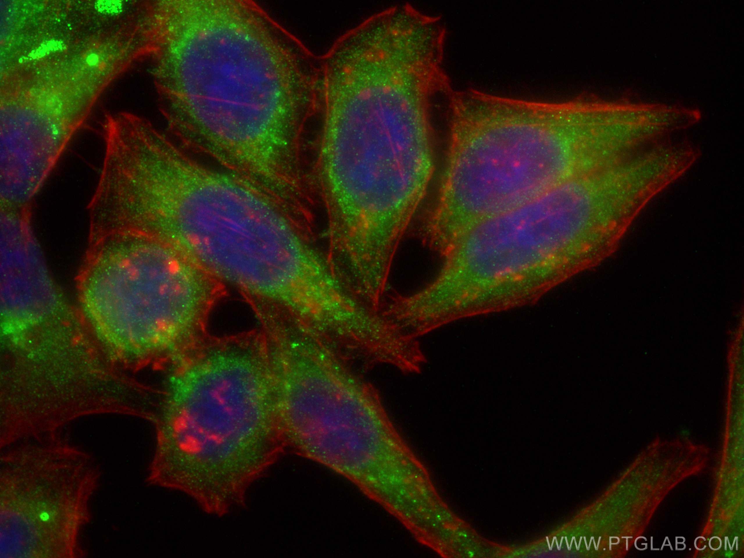 IF Staining of HepG2 using 11867-1-AP