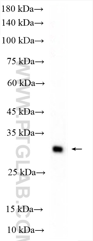 WB analysis of human plasma using 11867-1-AP