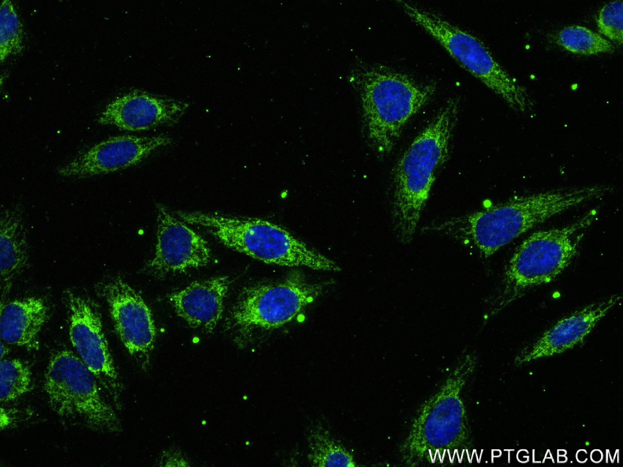 IF Staining of HepG2 using 82957-2-RR