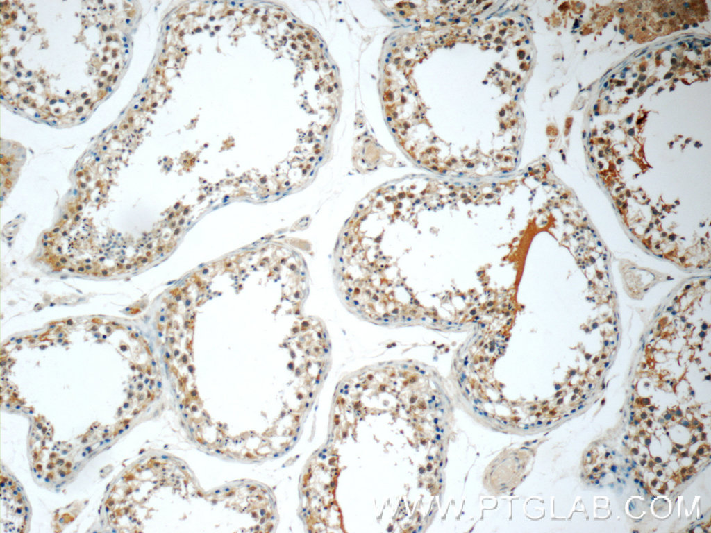 IHC staining of human testis using 24981-1-AP