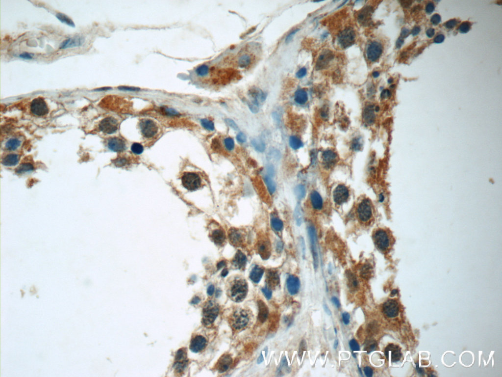 IHC staining of human testis using 24981-1-AP