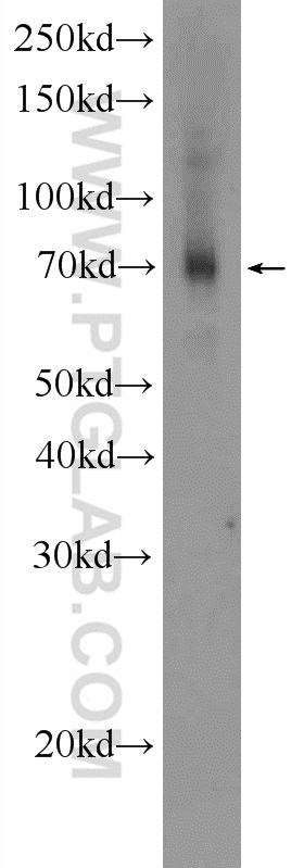 WB analysis of human placenta using 24981-1-AP