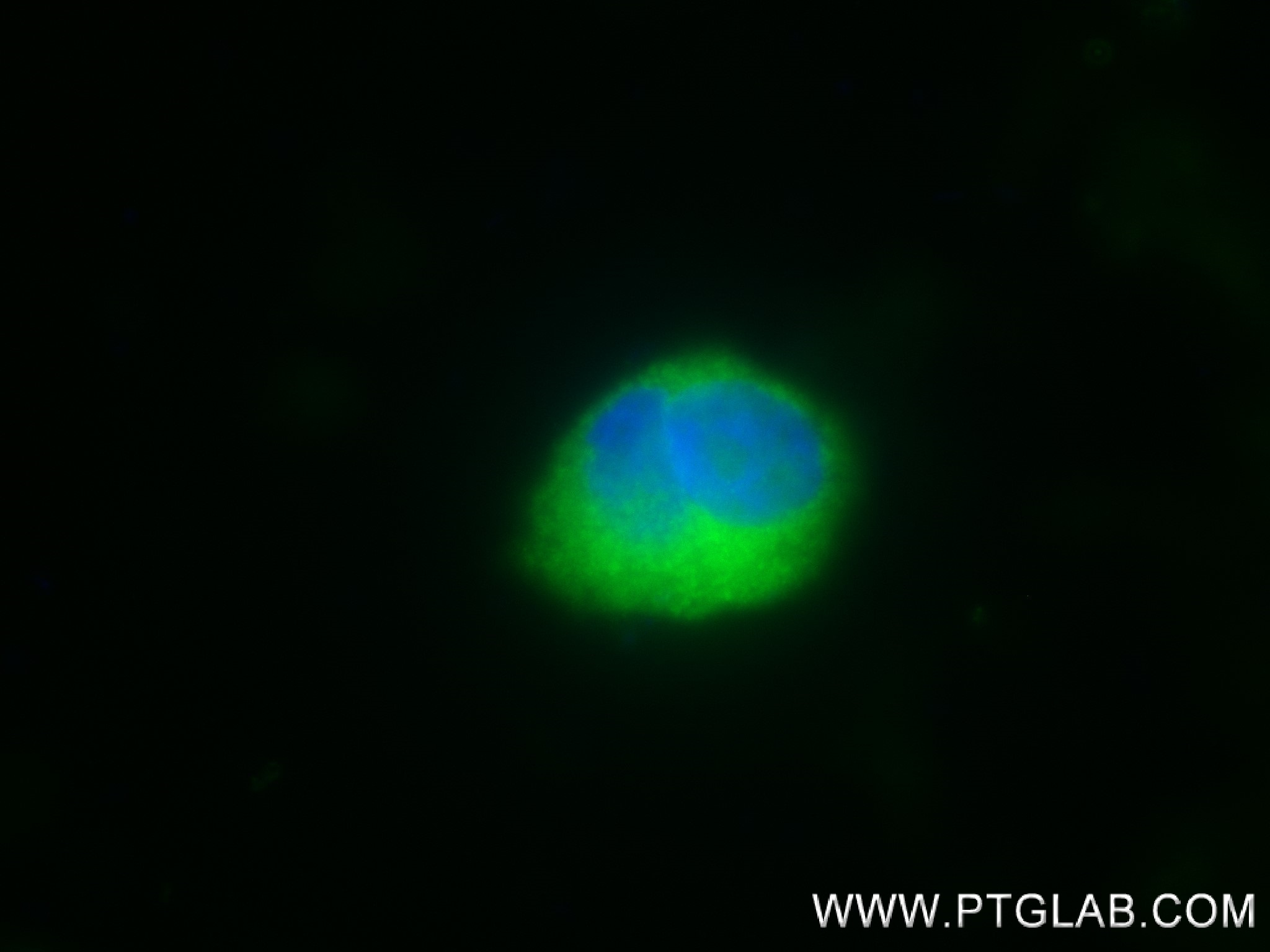 IF Staining of PC-3 using 83810-1-RR (same clone as 83810-1-PBS)