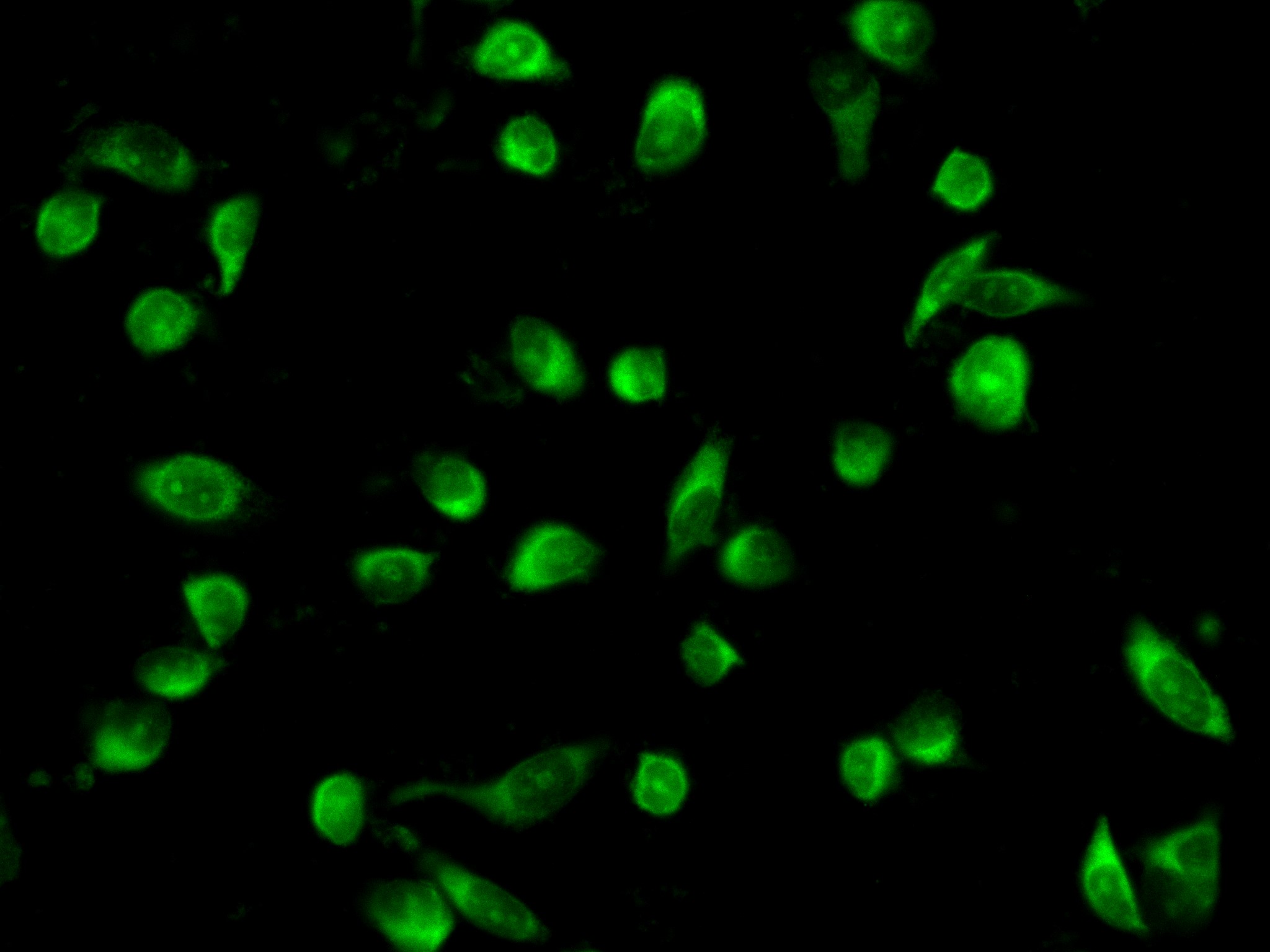 IF Staining of PC-3 using 83810-1-RR