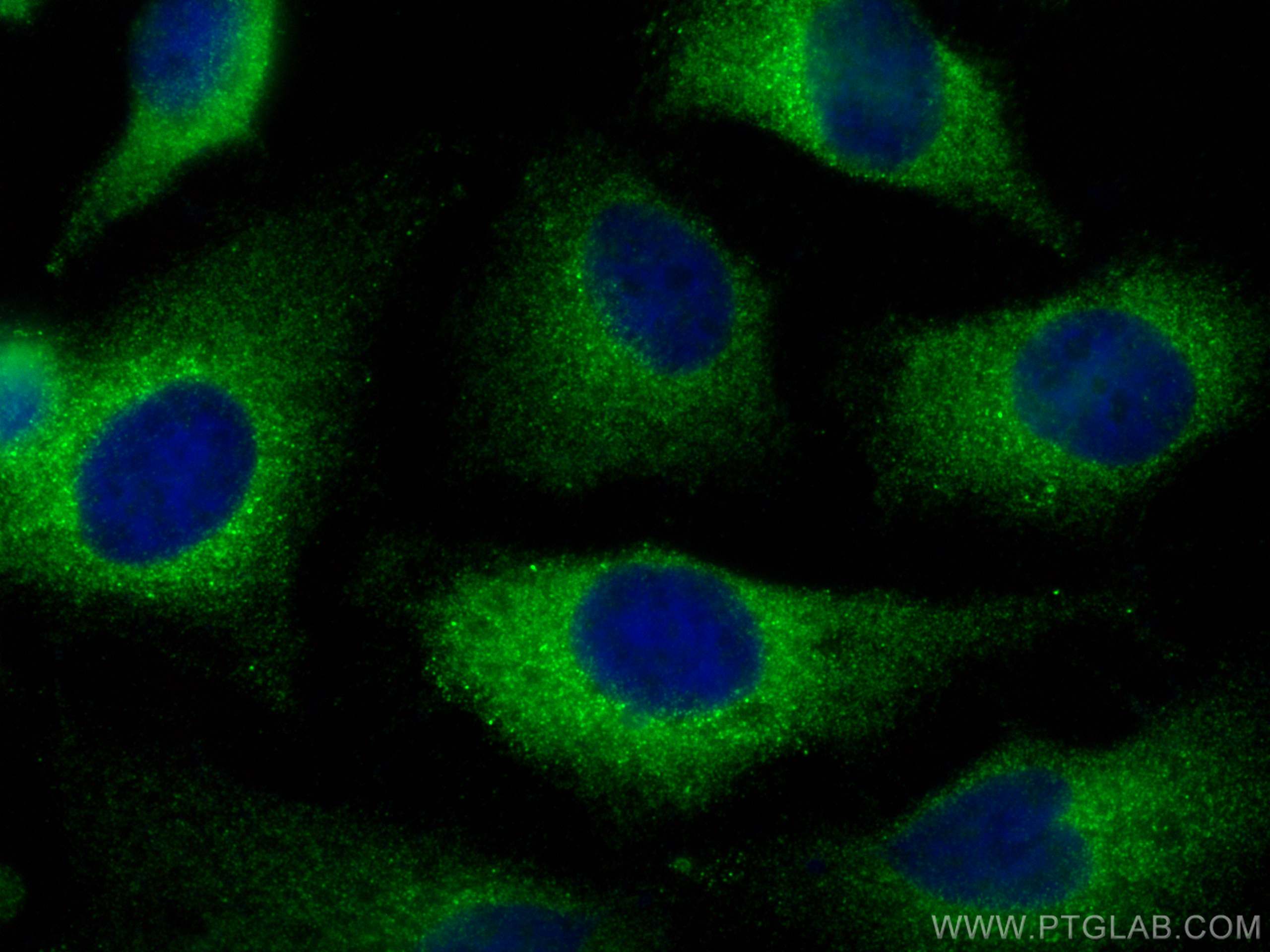 IF Staining of HeLa using 14037-1-AP