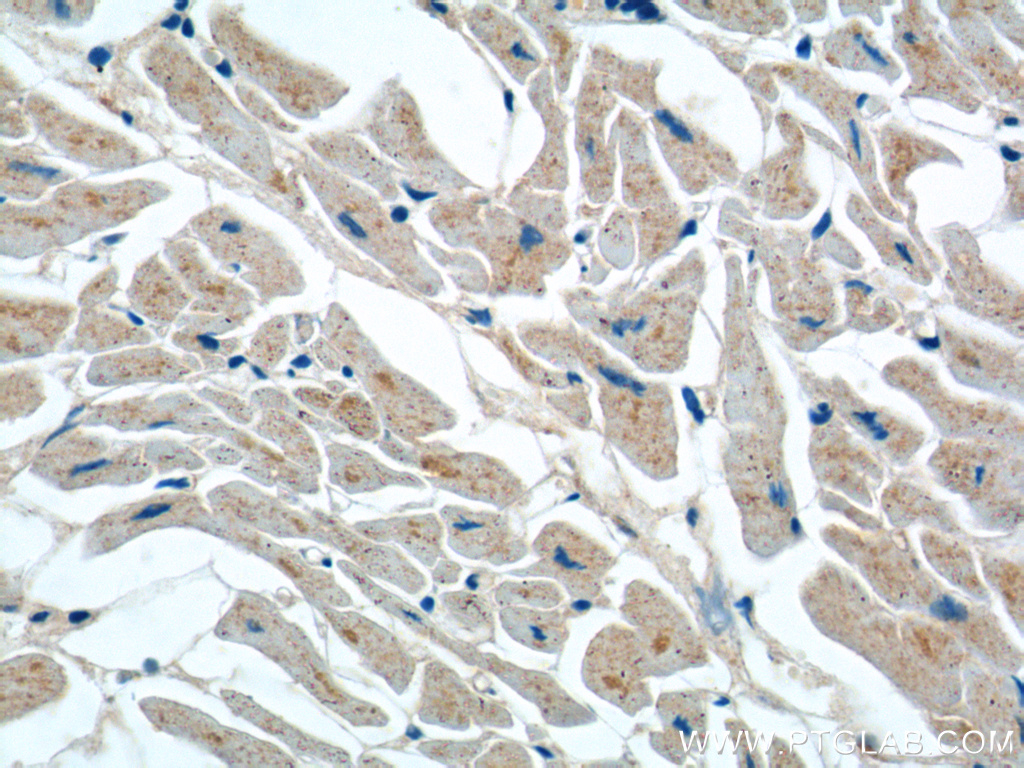 IHC staining of human heart using 14037-1-AP