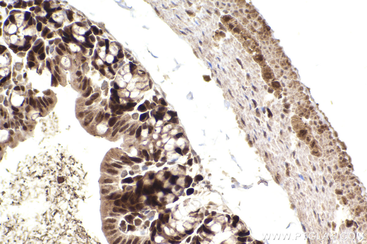 IHC staining of mouse small intestine using 14768-1-AP