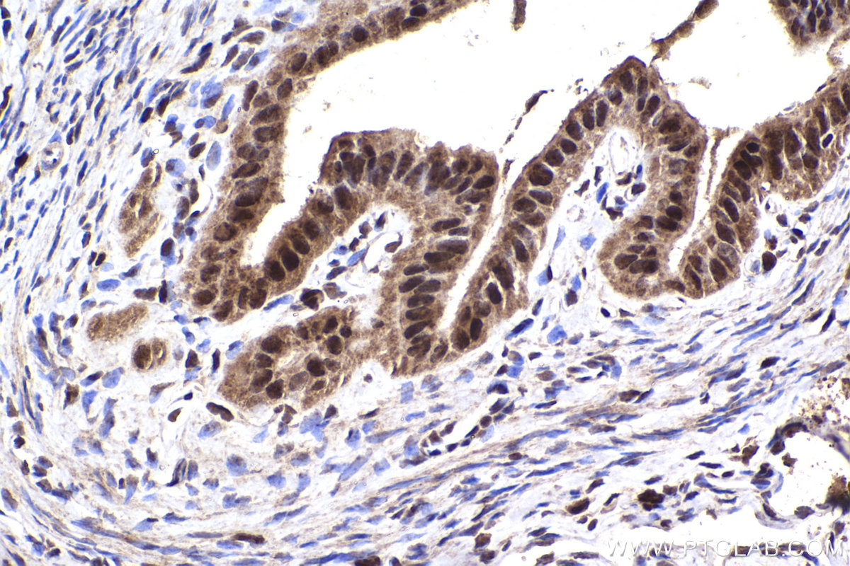 IHC staining of mouse ovary using 14768-1-AP