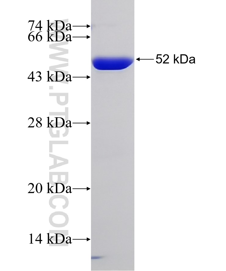 FEN1 fusion protein Ag33331 SDS-PAGE