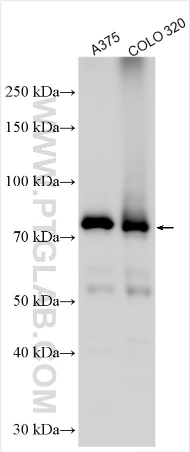 WB analysis using 22215-1-AP