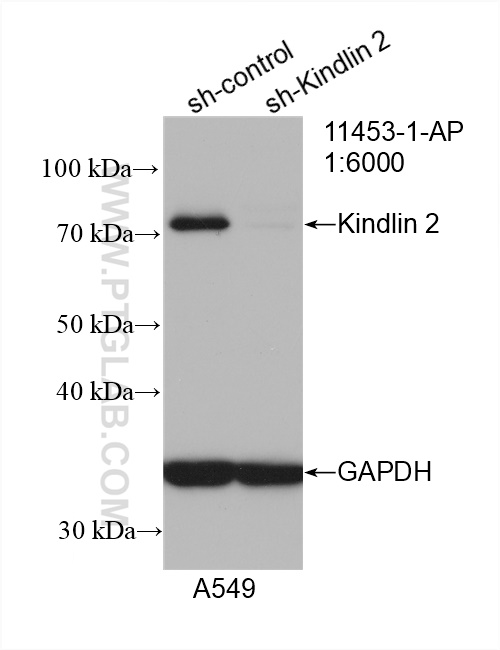 WB analysis of A549 using 11453-1-AP