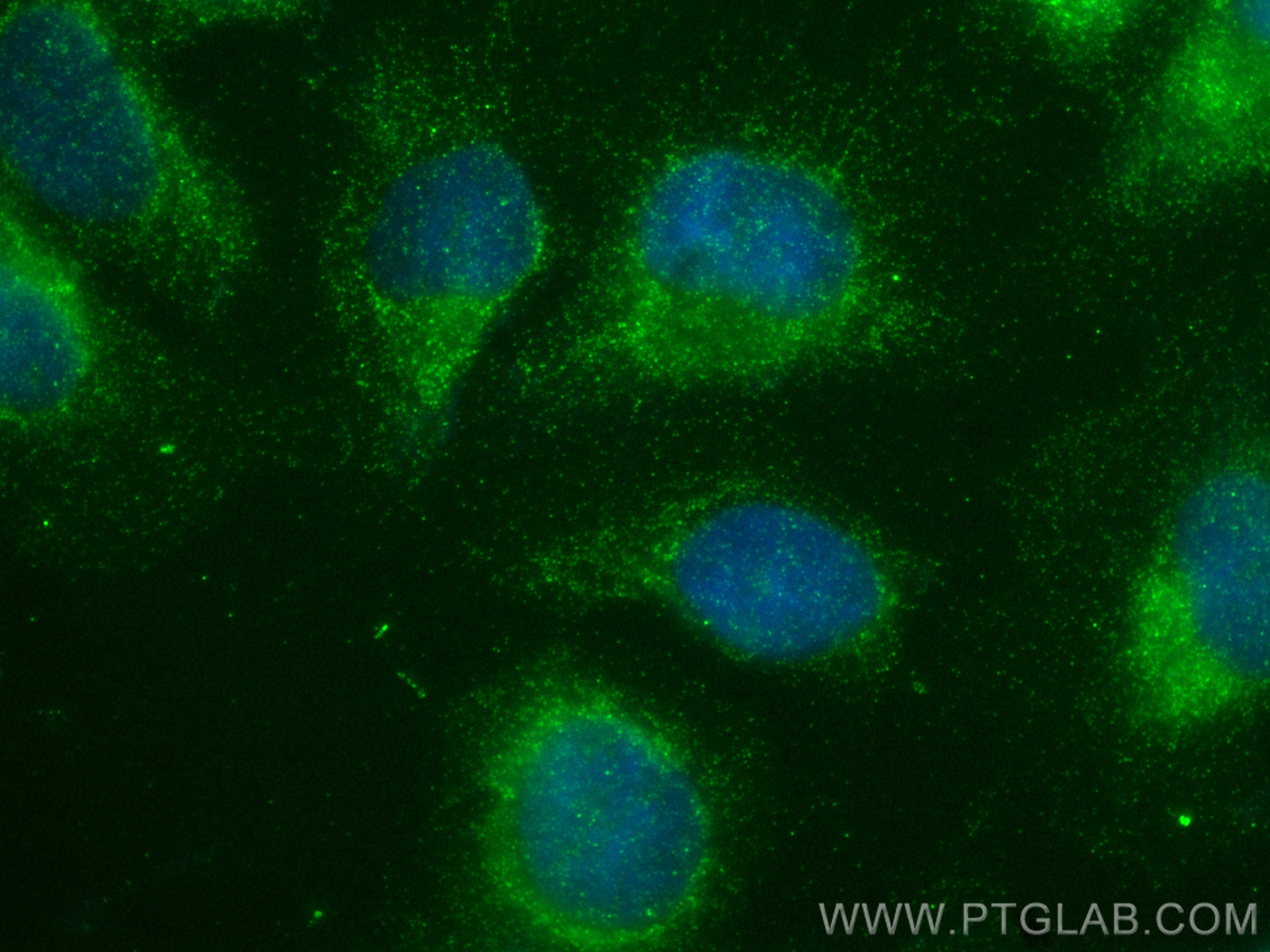 IF Staining of U2OS using 13141-1-AP