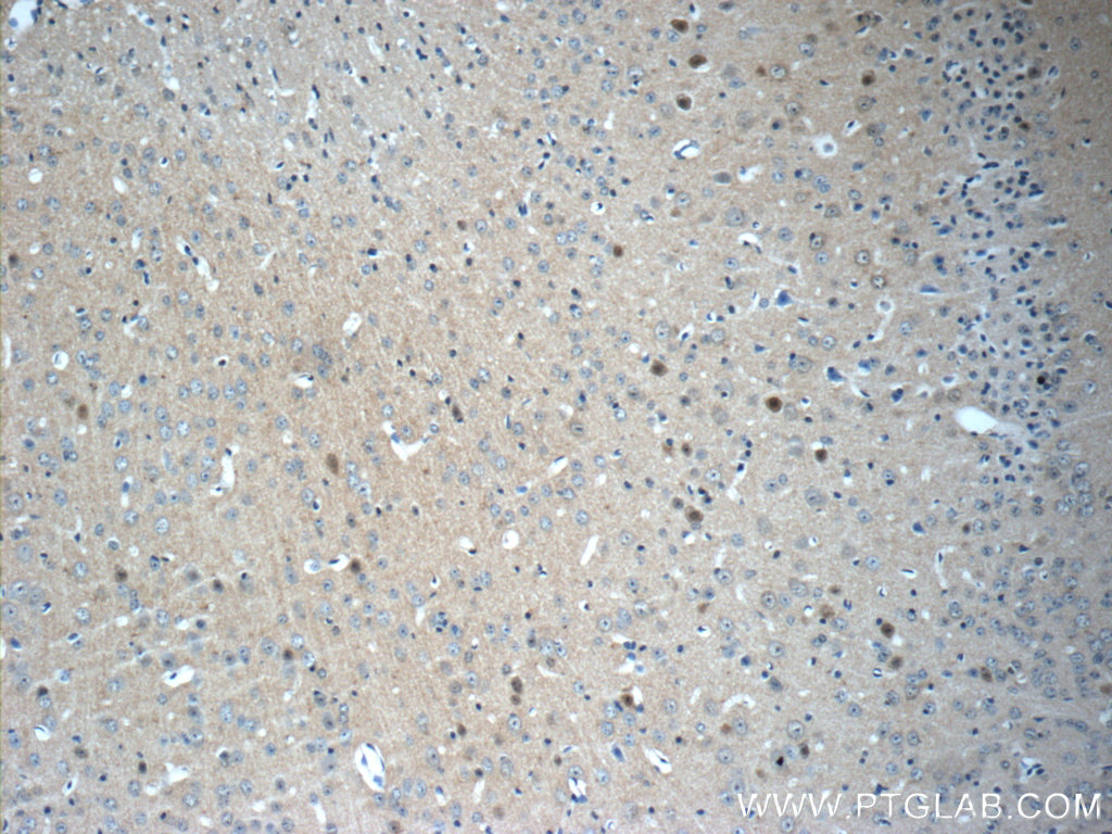 IHC staining of mouse brain using 13784-1-AP