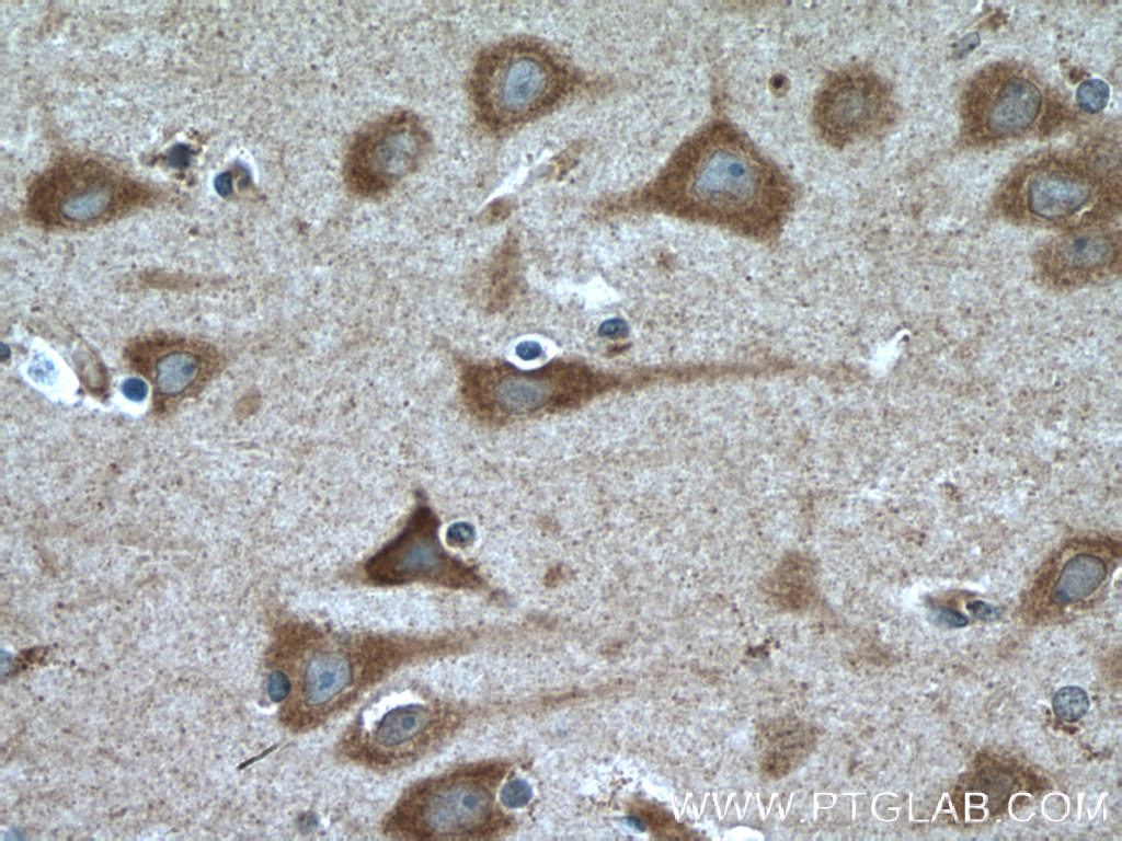 IHC staining of human brain using 26235-1-AP