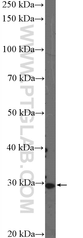 WB analysis of mouse heart using 26235-1-AP