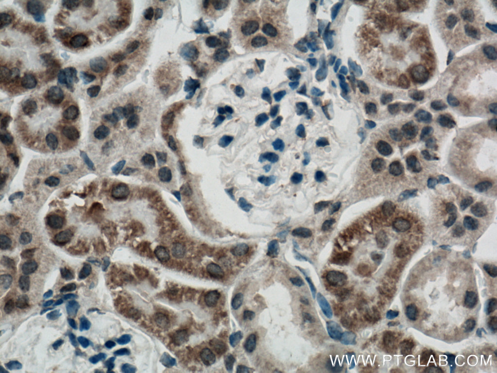 IHC staining of mouse kidney using 11495-1-AP