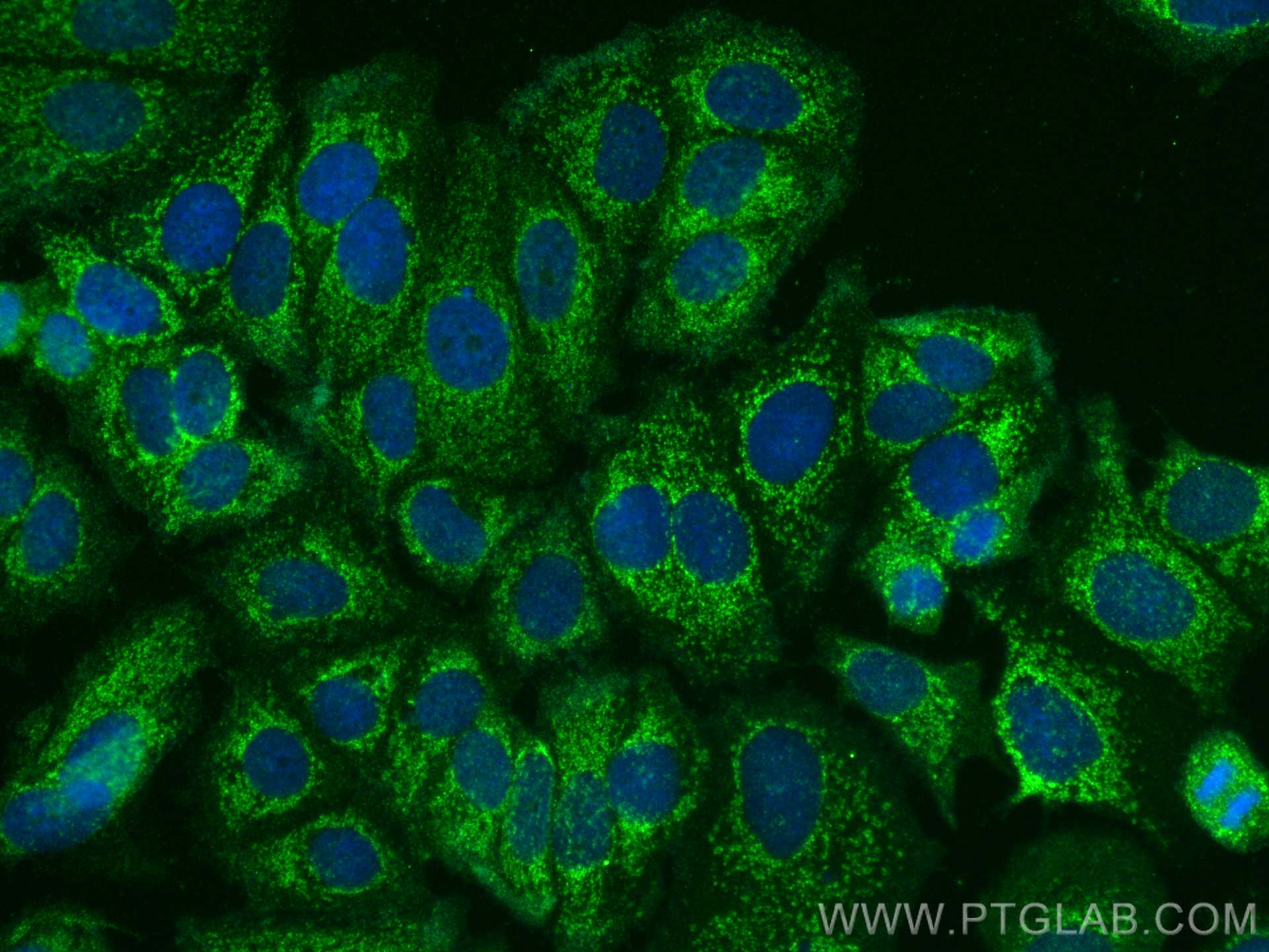 IF Staining of MCF-7 using 26554-1-AP