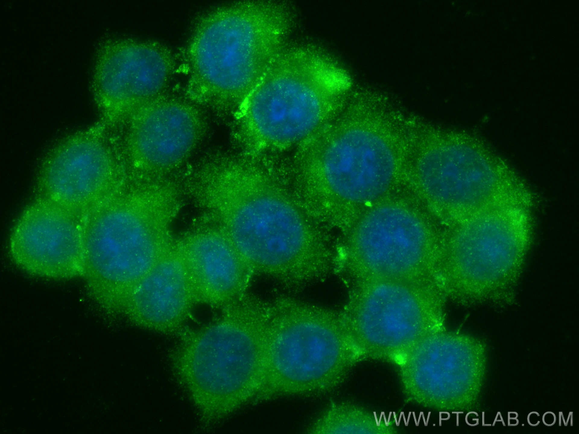 IF Staining of BxPC-3 using 13254-1-AP