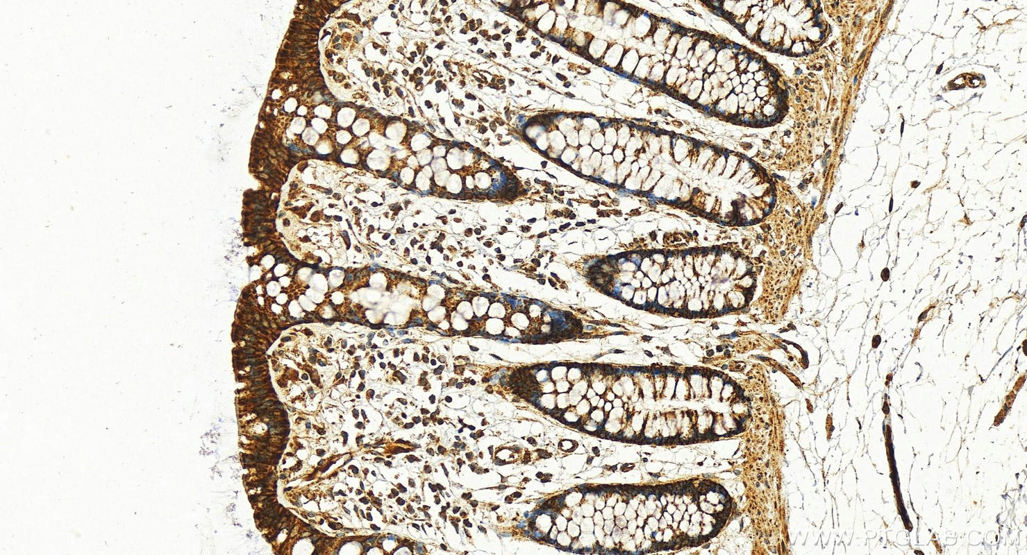 IHC staining of human colon using 30358-1-AP