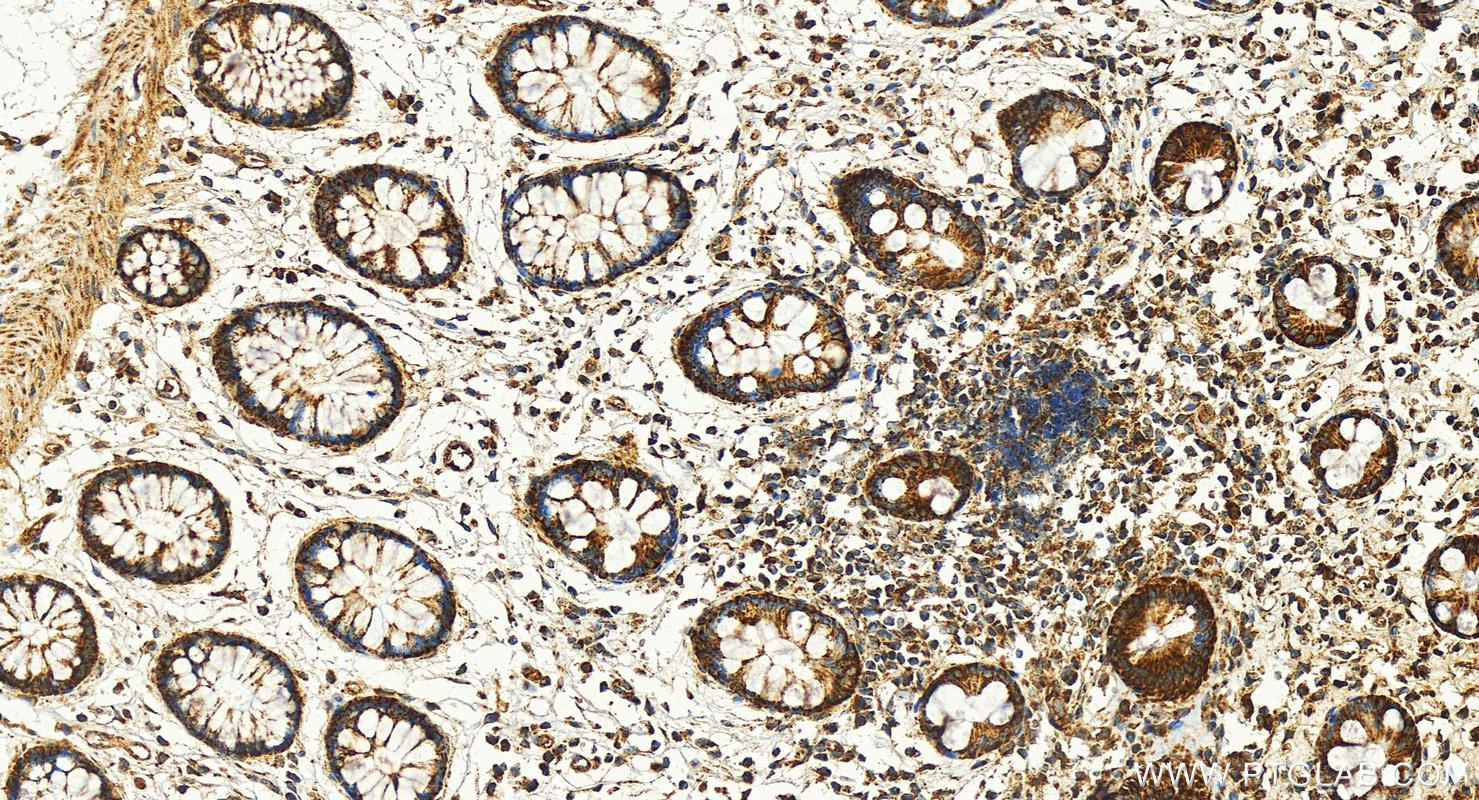 IHC staining of human colon using 30358-1-AP