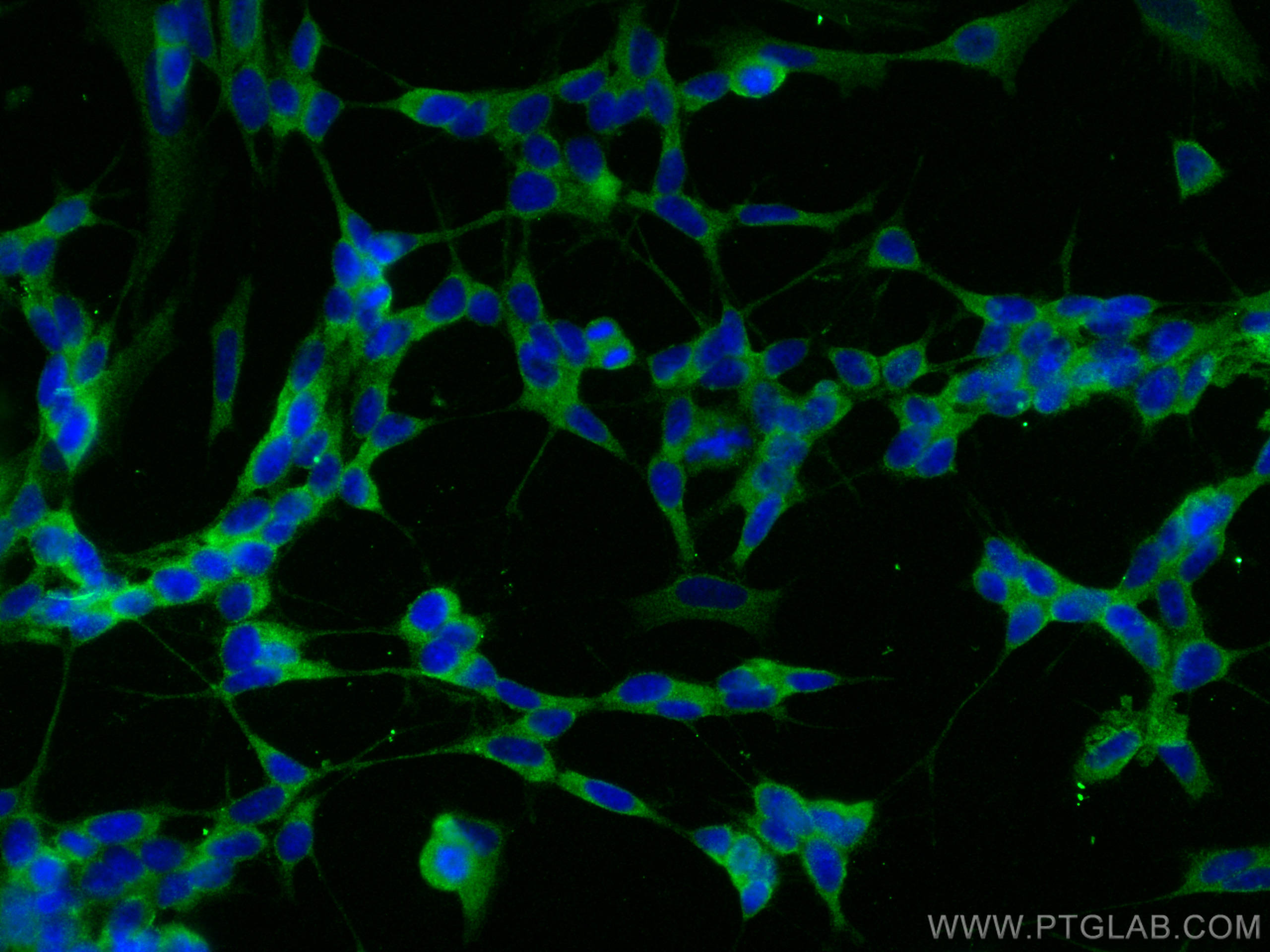 IF Staining of SH-SY5Y using 30358-1-AP