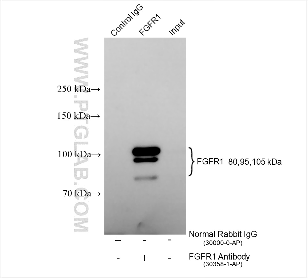 IP experiment of SH-SY5Y using 30358-1-AP