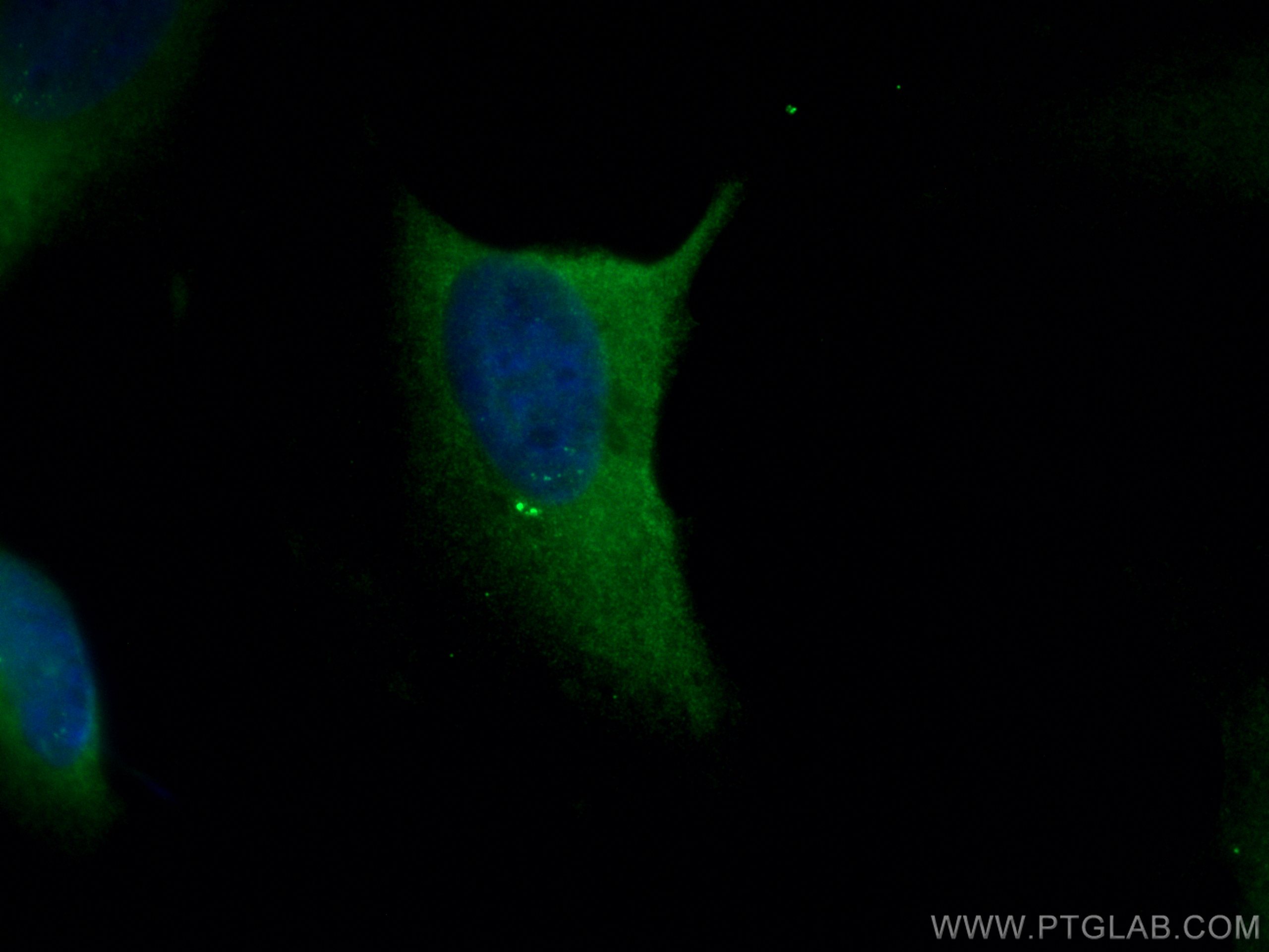 IF Staining of HeLa using 11343-1-AP (same clone as 11343-1-PBS)