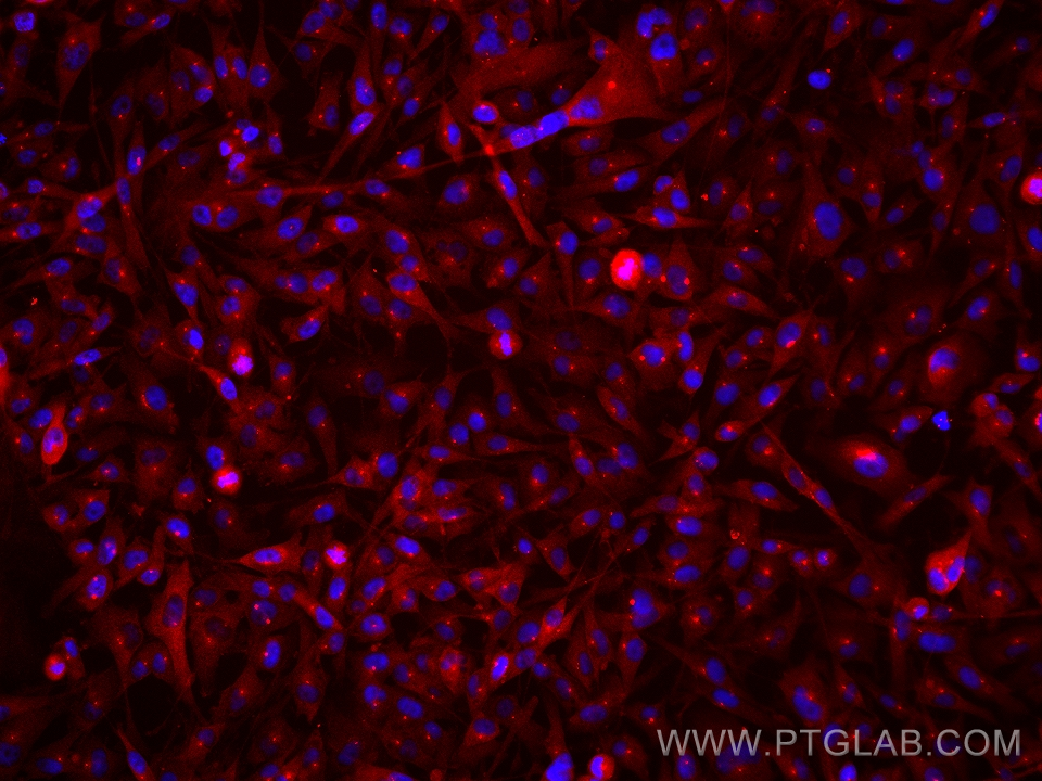 IF Staining of BT-549 using 67207-1-Ig (same clone as 67207-1-PBS)