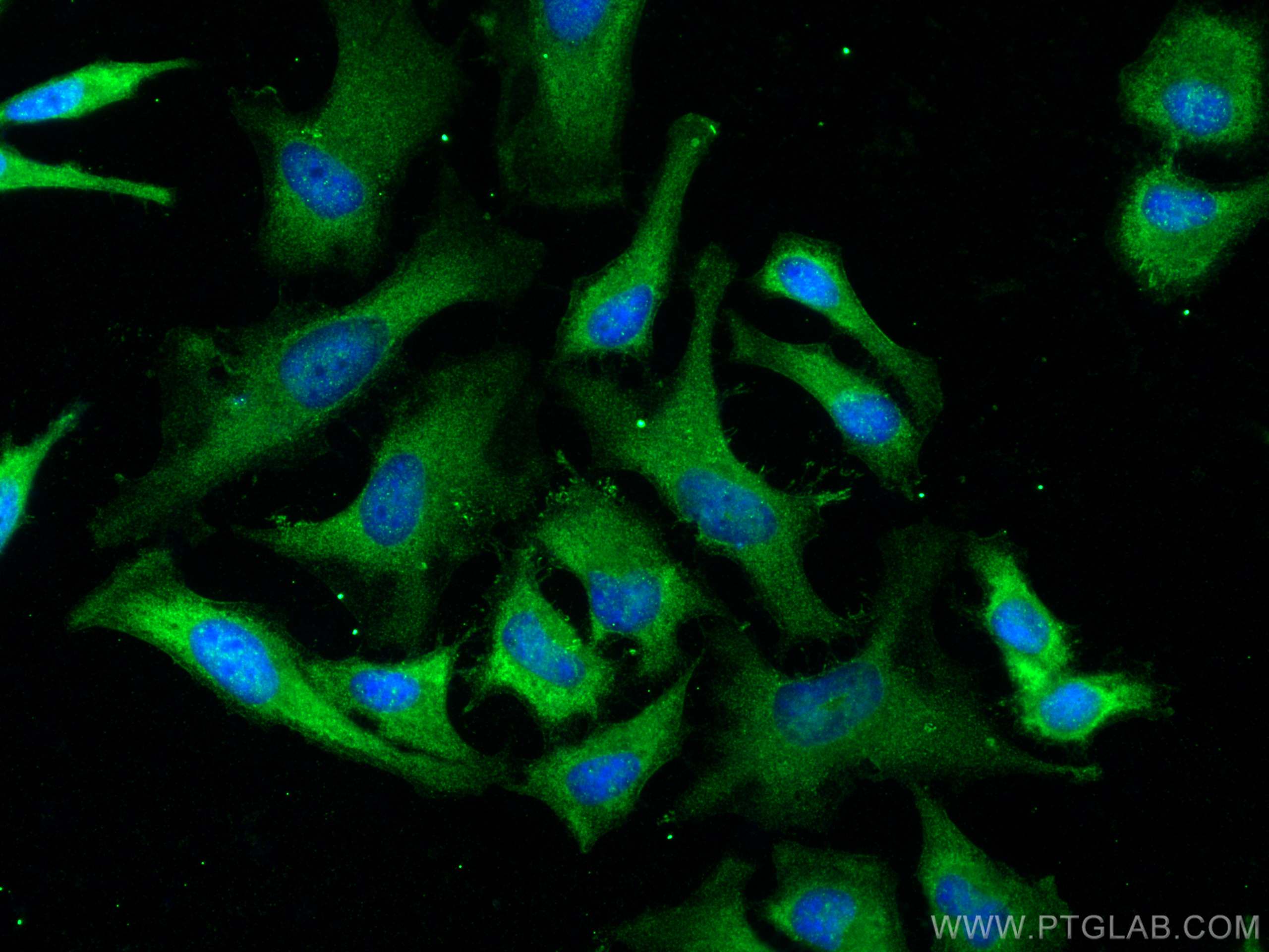 IF Staining of HeLa using 13042-1-AP