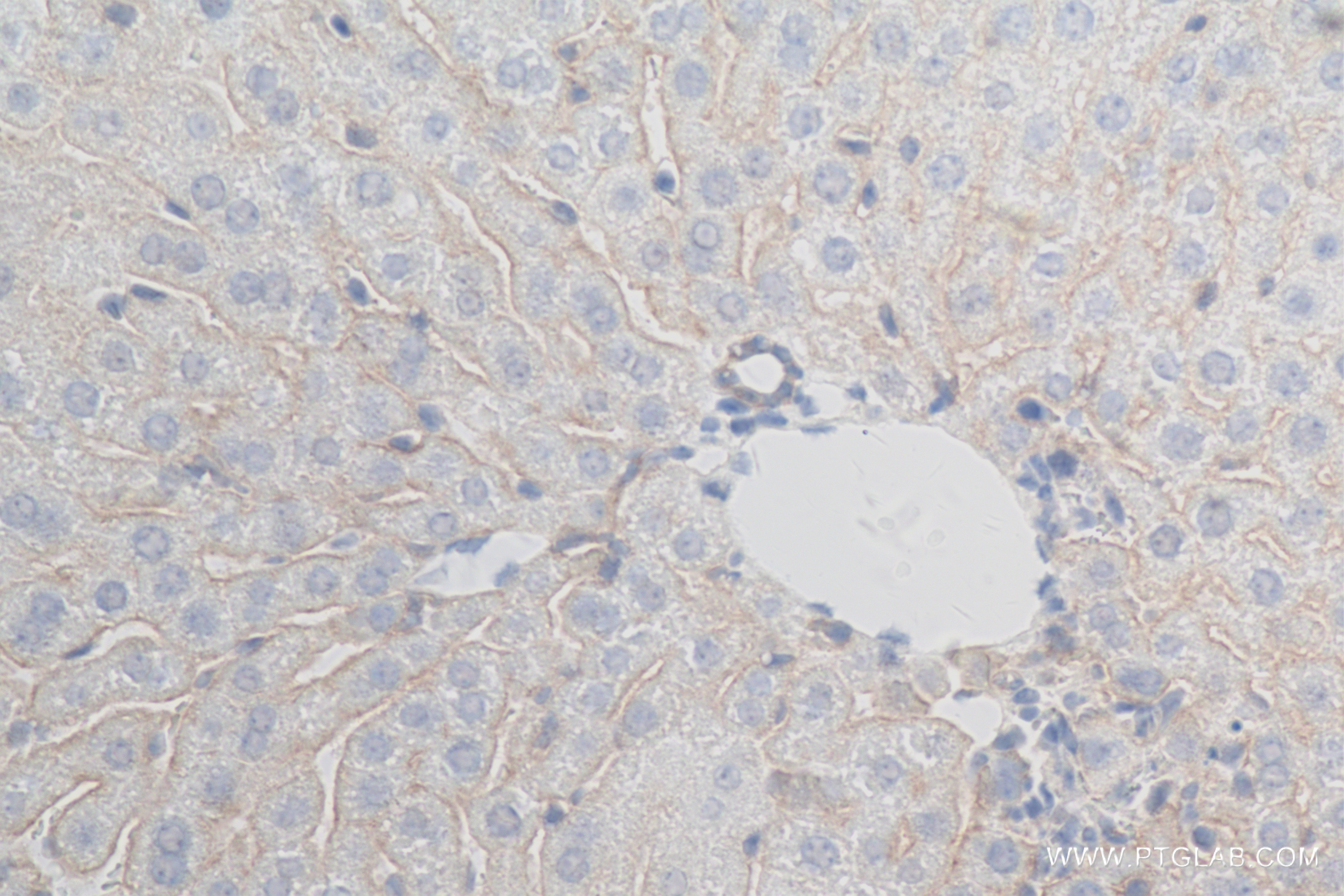 IHC staining of mouse liver using 84205-4-RR (same clone as 84205-4-PBS)