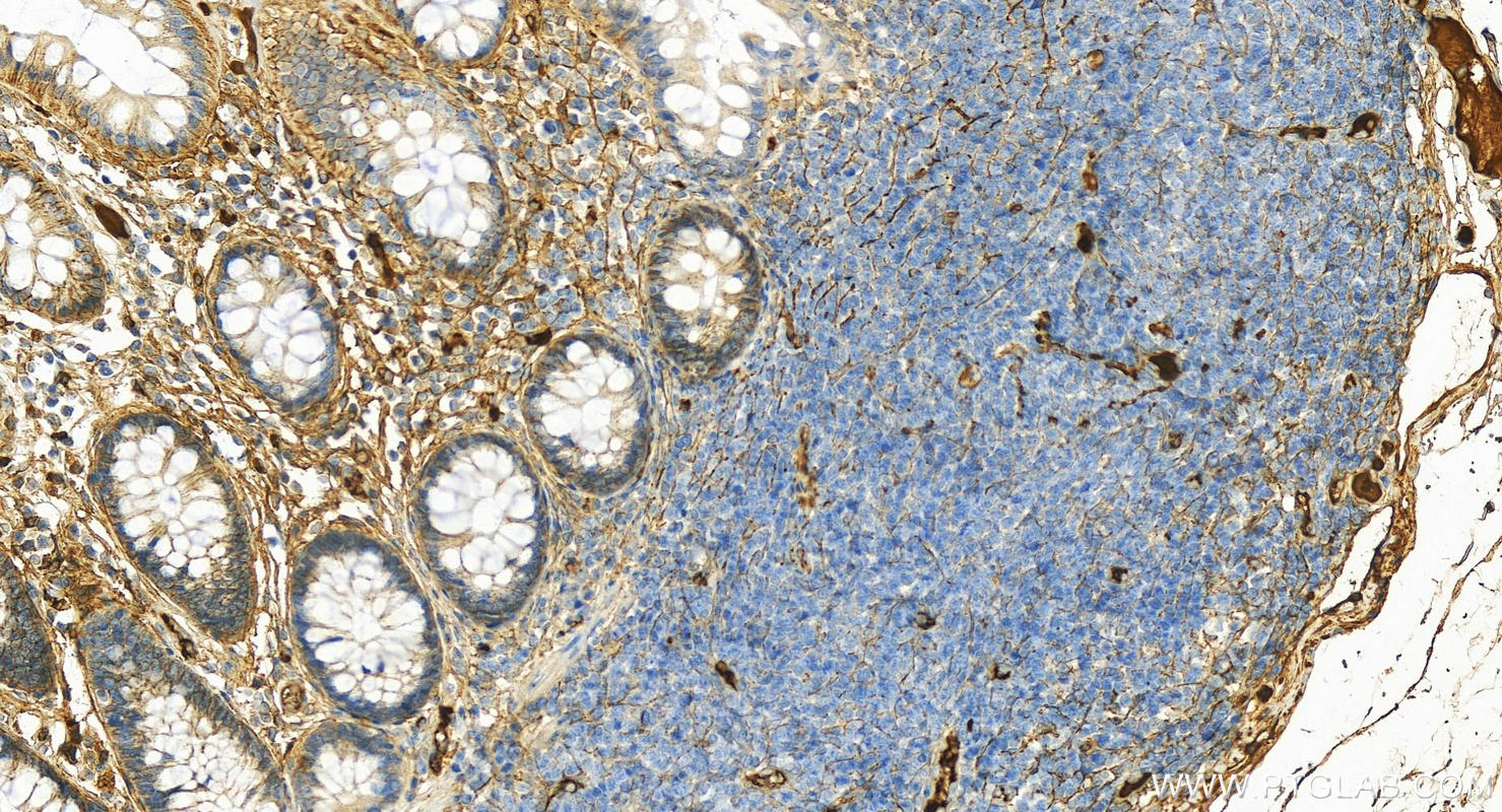 IHC staining of human normal colon using 15841-1-AP