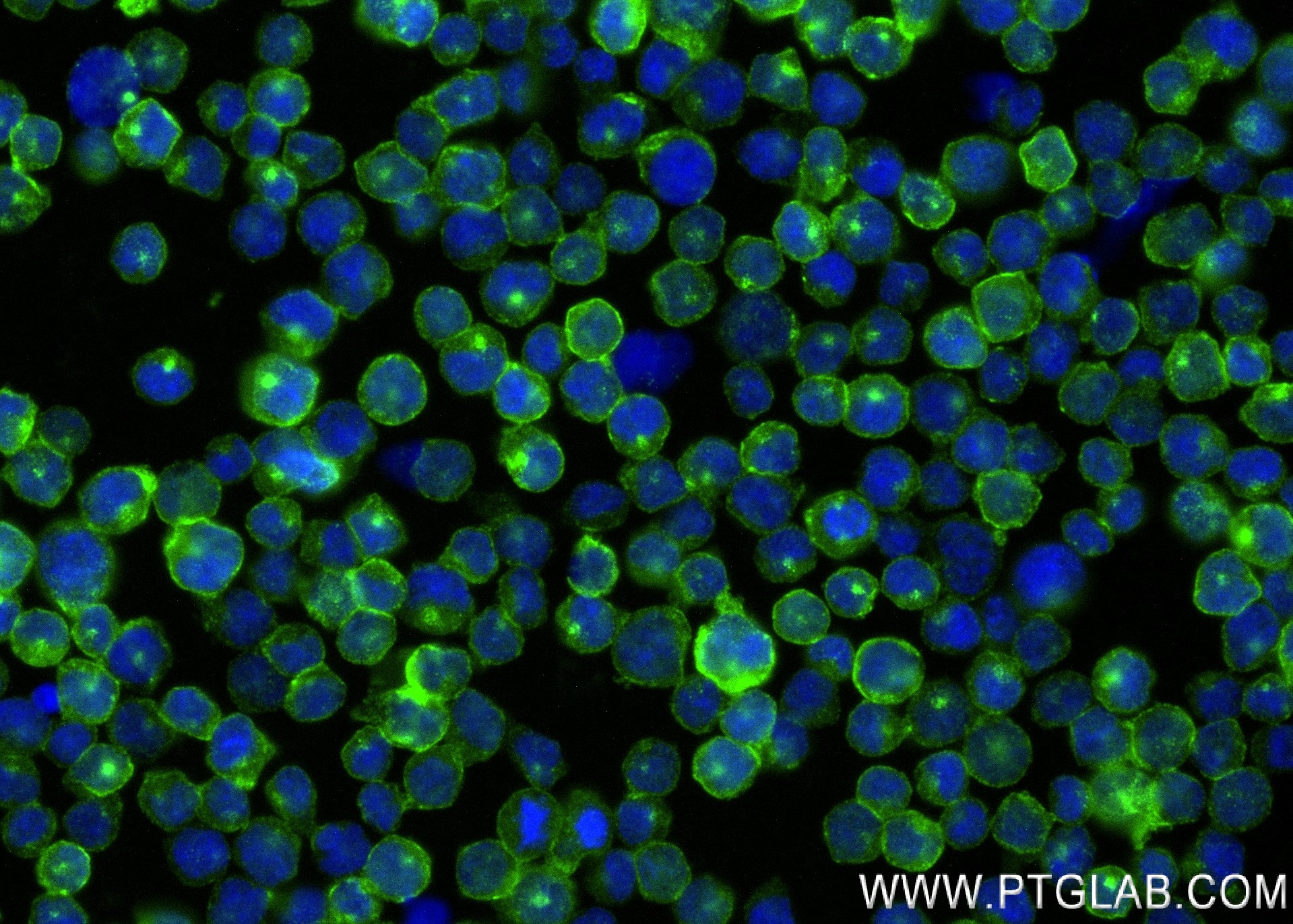 IF Staining of Raji using 83352-1-RR