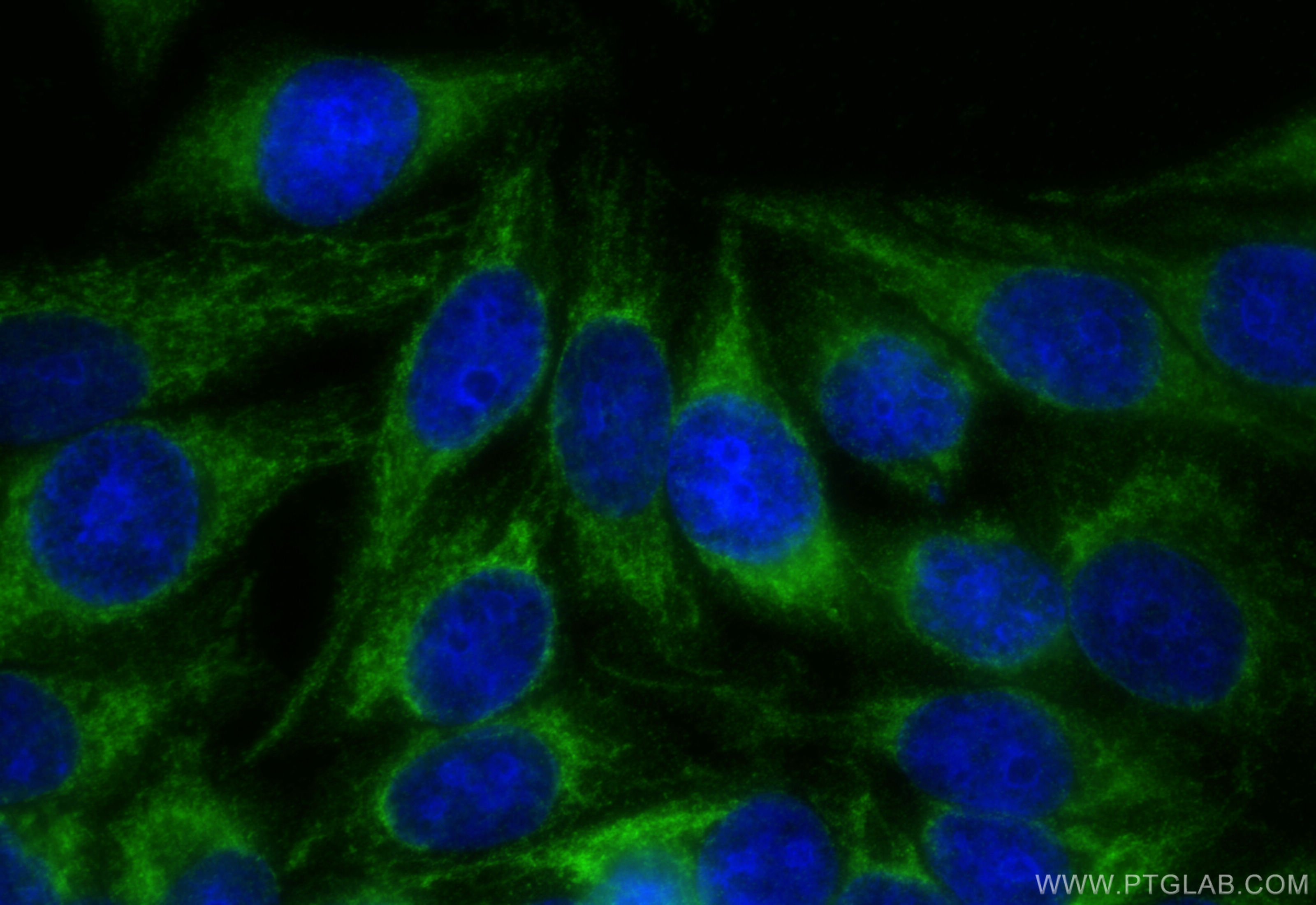 IF Staining of HepG2 using 10966-1-AP