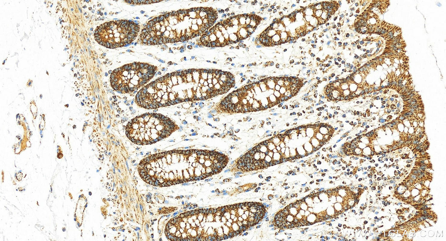 IHC staining of human normal colon using 11375-1-AP