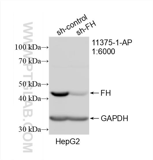 WB analysis of HepG2 using 11375-1-AP