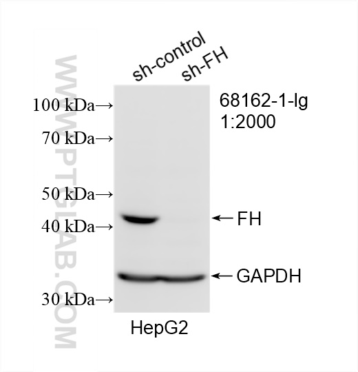 WB analysis of HepG2 using 68162-1-Ig (same clone as 68162-1-PBS)